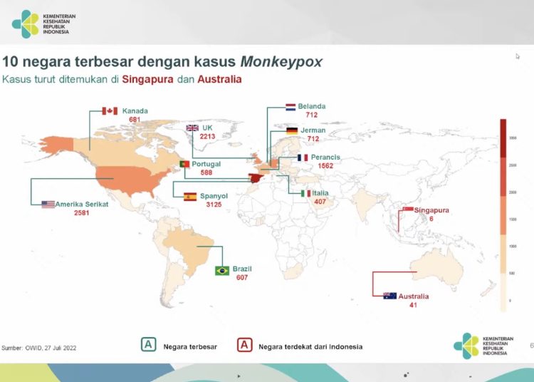 20220728 Kasus Cacar Monyet Belum Ditemukan di Indonesia